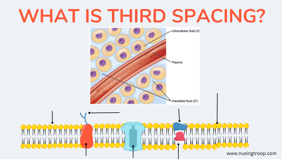 What is Third Spacing of Fluid?