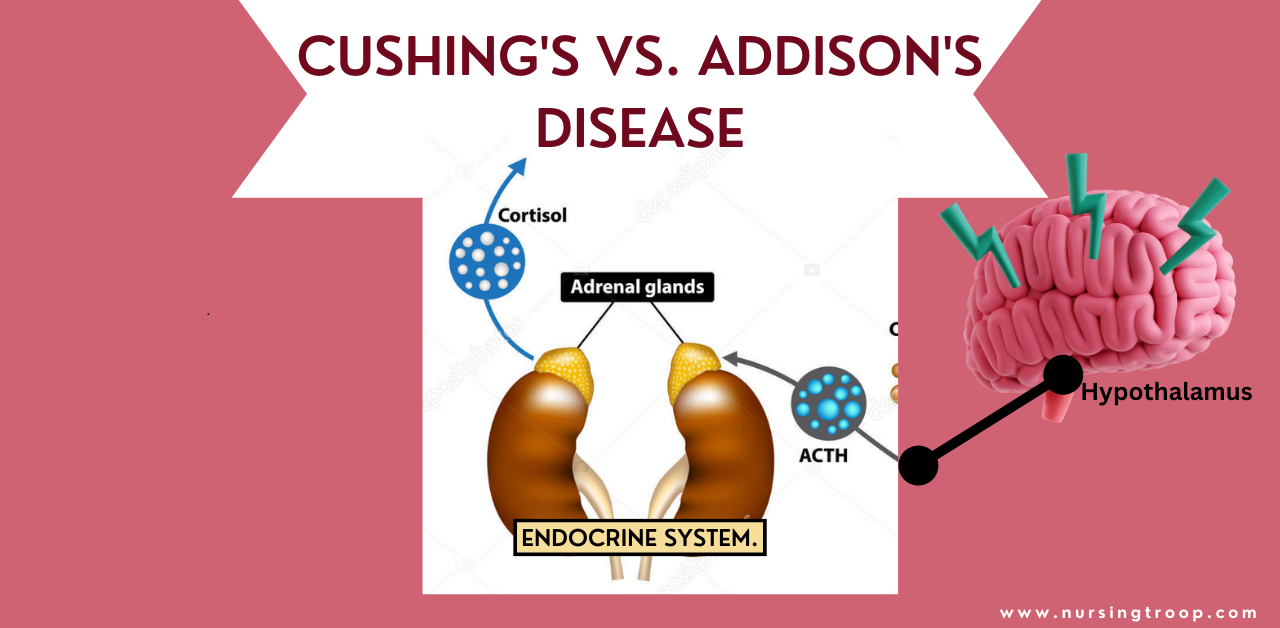 Cushing's vs Addison's