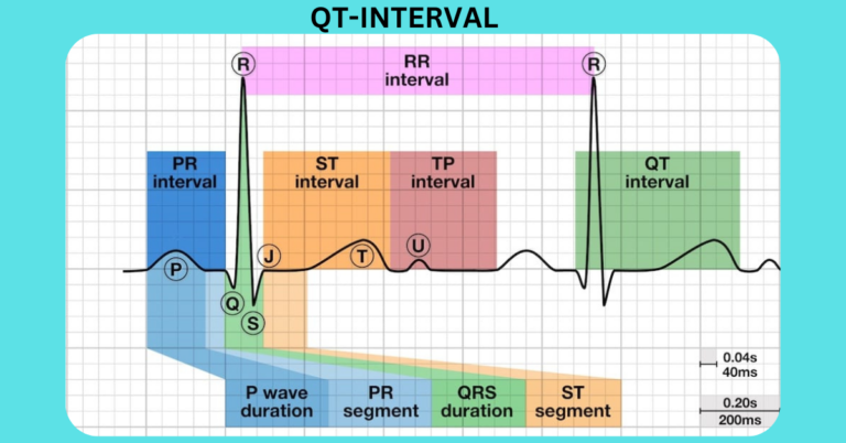 QT-INTERVAL