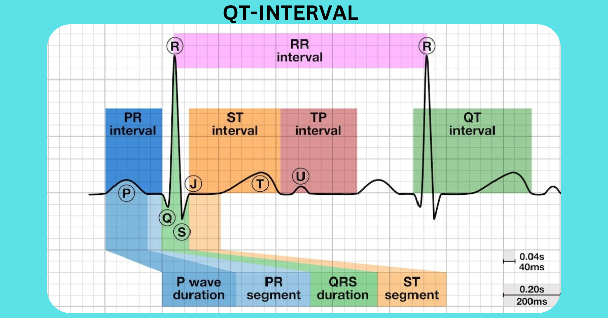 QT-INTERVAL