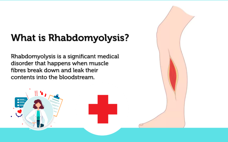 Rhabdomyolysis Pathophysiology